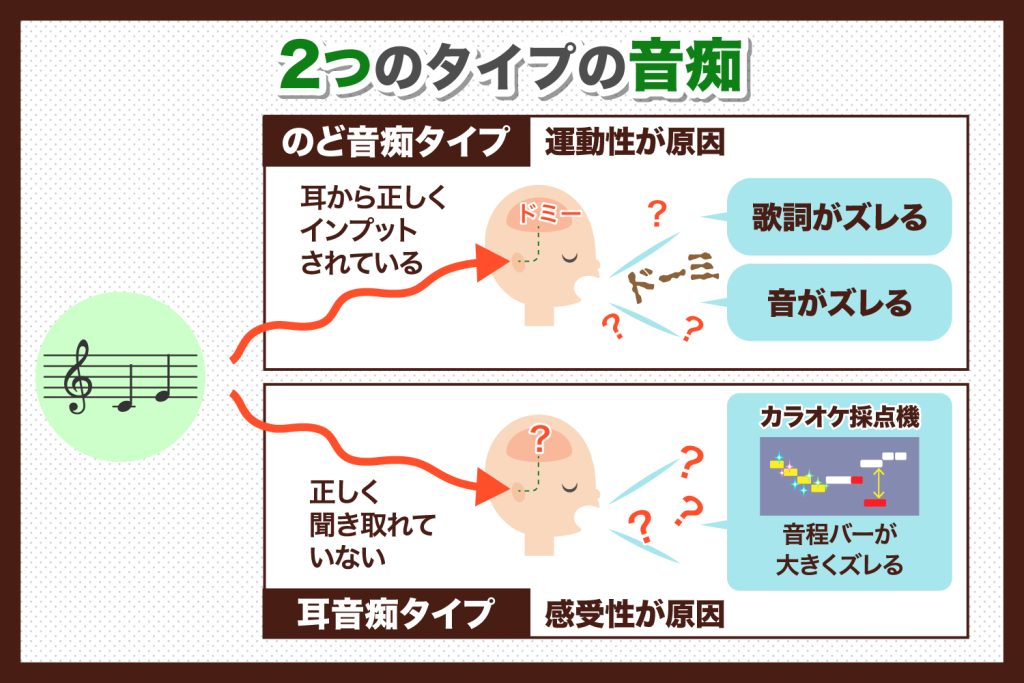 歌が下手な人の原因は何ですか？